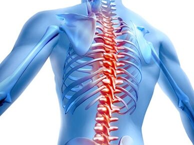 lesione spinale con osteocondrosi