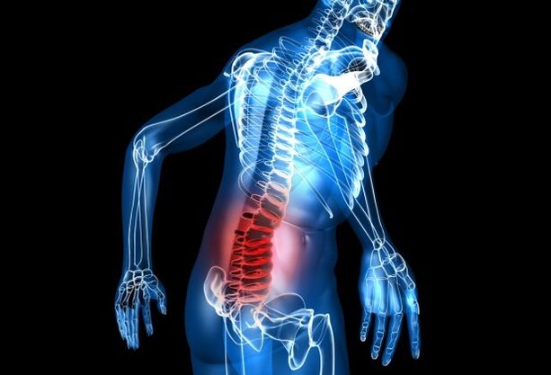 Sintomi di osteocondrosi