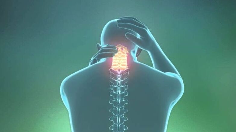 Osteocondrosi della regione cervicale