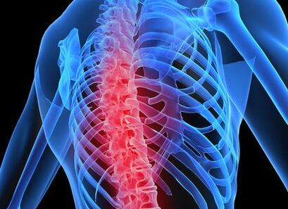 osteocondrosi della colonna vertebrale toracica