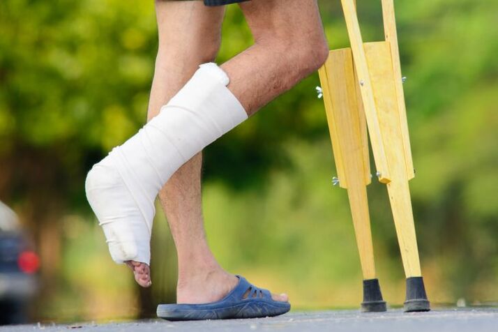lesioni alla caviglia come causa di artrosi