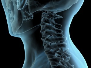 metodi per diagnosticare l'osteocondrosi del collo